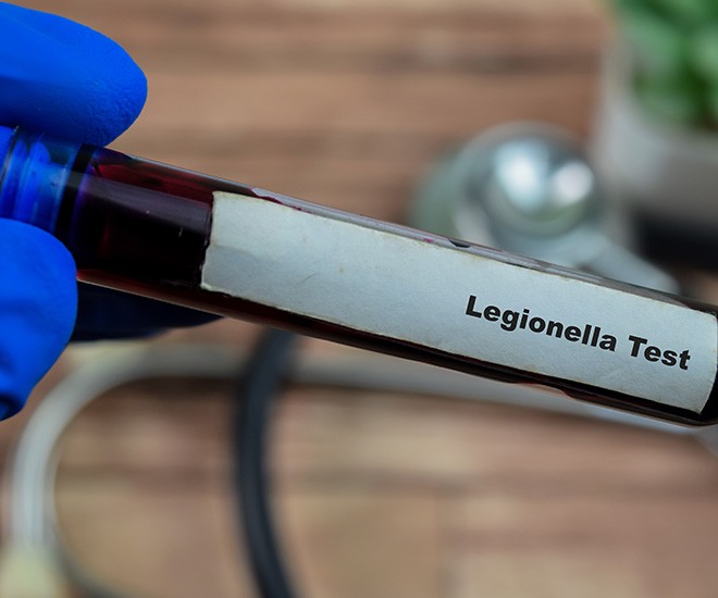 Vyhněte se nebezpečí v podobě Legionelly